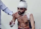 लखनऊ के एमिटी लॉ कालेज में स्टूडेंट के बीच  क्लास के अंदर छात्र पर साथी ने किया हमला, गंभीर