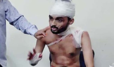 लखनऊ के एमिटी लॉ कालेज में स्टूडेंट के बीच  क्लास के अंदर छात्र पर साथी ने किया हमला, गंभीर